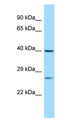 DJ858B16.2 / PISD antibody Western Blot of 721_B.