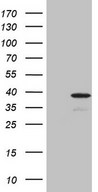HEK293T cells were transfected with the pCMV6-ENTRY control (Left lane) or pCMV6-ENTRY PISD (Right lane) cDNA for 48 hrs and lysed. Equivalent amounts of cell lysates (5 ug per lane) were separated by SDS-PAGE and immunoblotted with anti-PISD (1:2000).