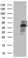 HEK293T cells were transfected with the pCMV6-ENTRY control (Left lane) or pCMV6-ENTRY PISD (Right lane) cDNA for 48 hrs and lysed. Equivalent amounts of cell lysates (5 ug per lane) were separated by SDS-PAGE and immunoblotted with anti-PISD.