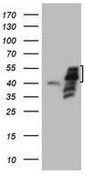 HEK293T cells were transfected with the pCMV6-ENTRY control (Left lane) or pCMV6-ENTRY PISD (Right lane) cDNA for 48 hrs and lysed. Equivalent amounts of cell lysates (5 ug per lane) were separated by SDS-PAGE and immunoblotted with anti-PISD.