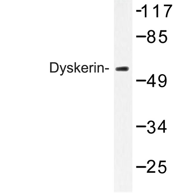 Western blot of Dyskerin (K203) pAb in extracts from HeLa cells.