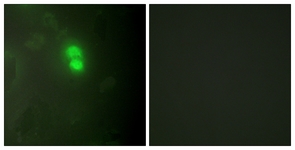 Immunofluorescence of HeLa cells, using Dyskerin Antibody. The picture on the right is treated with the synthesized peptide.
