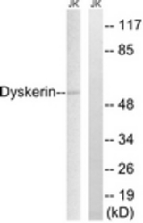 Western blot of extracts from Jurkat cells, using Dyskerin Antibody. The lane on the right is treated with the synthesized peptide.