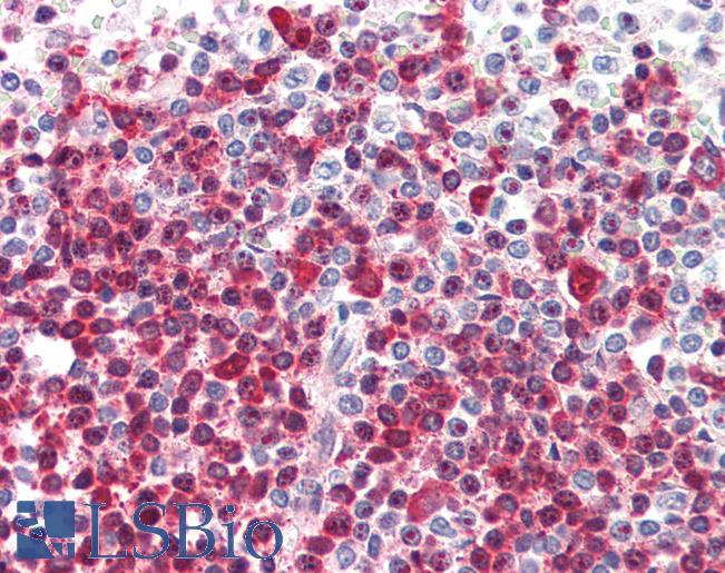 Anti-DKC1 antibody IHC of human spleen. Immunohistochemistry of formalin-fixed, paraffin-embedded tissue after heat-induced antigen retrieval. Antibody LS-B2299 concentration 5 ug/ml.