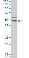 DKK1 monoclonal antibody (M08), clone 2B12 Western blot of DKK1 expression in HeLa.