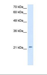 HepG2 cell lysate. Antibody concentration: 2.5 ug/ml. Gel concentration: 12%.