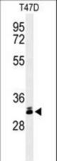 Western blot of DKK1 Antibody in T47D cell line lysates (35 ug/lane). DKK1 (arrow) was detected using the purified antibody.