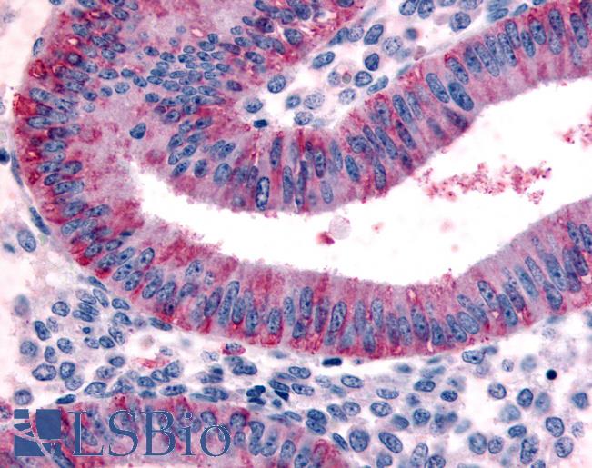 Anti-DKK1 antibody LS-A2865 IHC of human uterus, endometrium. Immunohistochemistry of formalin-fixed, paraffin-embedded tissue after heat-induced antigen retrieval.