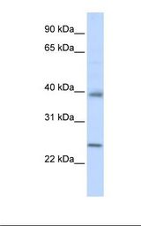 Hela cell lysate. Antibody concentration: 1.0 ug/ml. Gel concentration: 12%.