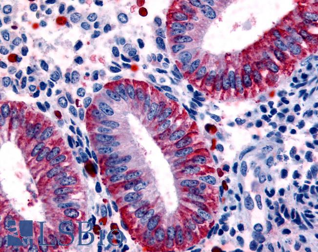 Anti-DKK1 antibody LS-A2868 IHC of human uterus, endometrium. Immunohistochemistry of formalin-fixed, paraffin-embedded tissue after heat-induced antigen retrieval.
