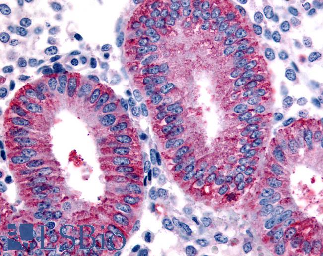 Anti-DKK1 antibody LS-A2867 IHC of human uterus, endometrium. Immunohistochemistry of formalin-fixed, paraffin-embedded tissue after heat-induced antigen retrieval.