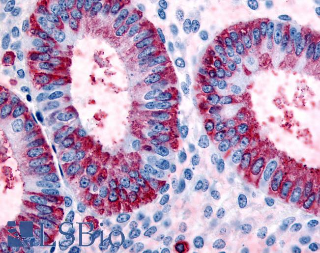 Anti-DKK1 antibody LS-A2866 IHC of human uterus, endometrium. Immunohistochemistry of formalin-fixed, paraffin-embedded tissue after heat-induced antigen retrieval.