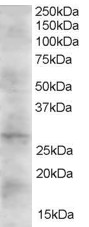 Antibody (2 ug/ml) staining of Human Heart lysate (35 ug protein in RIPA buffer). Primary incubation was 1 hour. Detected by chemiluminescence.