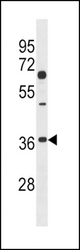 DKK2 Antibody (C239) western blot of 293 cell line lysates (35 ug/lane). The DKK2 antibody detected the DKK2 protein (arrow).