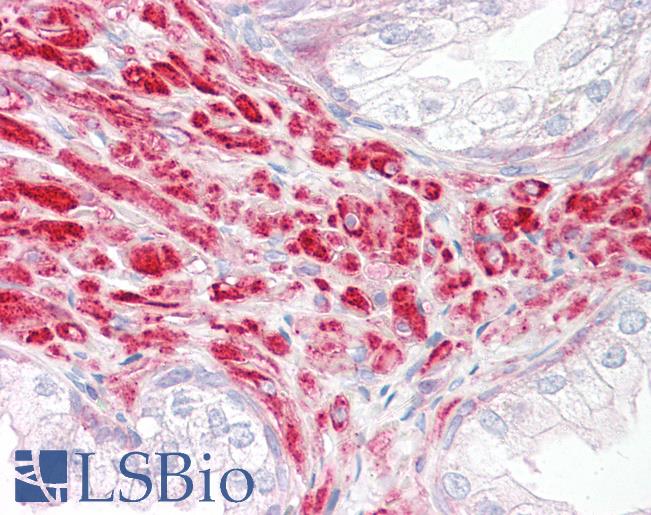 Anti-DKK2 antibody IHC of human prostate. Immunohistochemistry of formalin-fixed, paraffin-embedded tissue after heat-induced antigen retrieval. Antibody LS-B8226 dilution 2.5-5 ug/ml.