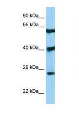 DKK3 antibody LS-C146493 Western blot of 293T Cell lysate. Antibody concentration 1 ug/ml.