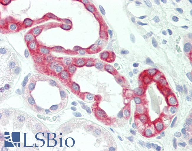 Anti-CLDN8 / Claudin 8 antibody IHC staining of human kidney. Immunohistochemistry of formalin-fixed, paraffin-embedded tissue after heat-induced antigen retrieval.
