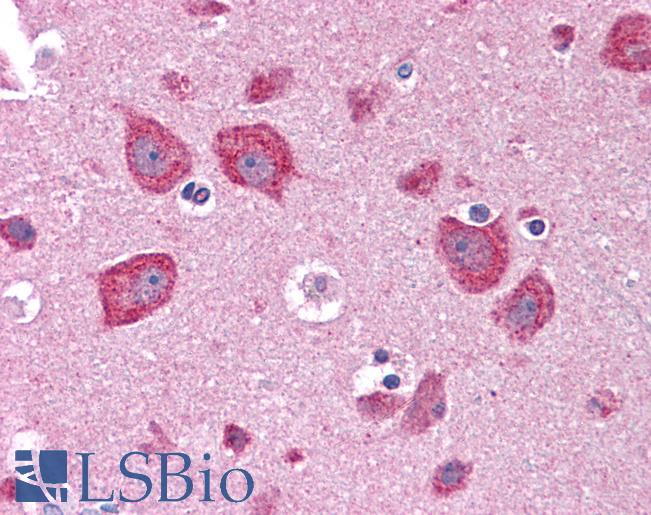 Anti-DKK3 antibody IHC of human brain, cortex. Immunohistochemistry of formalin-fixed, paraffin-embedded tissue after heat-induced antigen retrieval. Antibody LS-B4434 concentration 5 ug/ml.