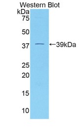 Western blot of recombinant DKK4.