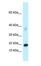 DKK4 antibody Western Blot of Mouse Pancreas.