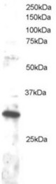 Antibody staining (1 ug/ml) of Jurkat lysate (RIPA buffer, 30 ug total protein per lane). Primary incubated for 1 hour. Detected by Western blot of chemiluminescence.