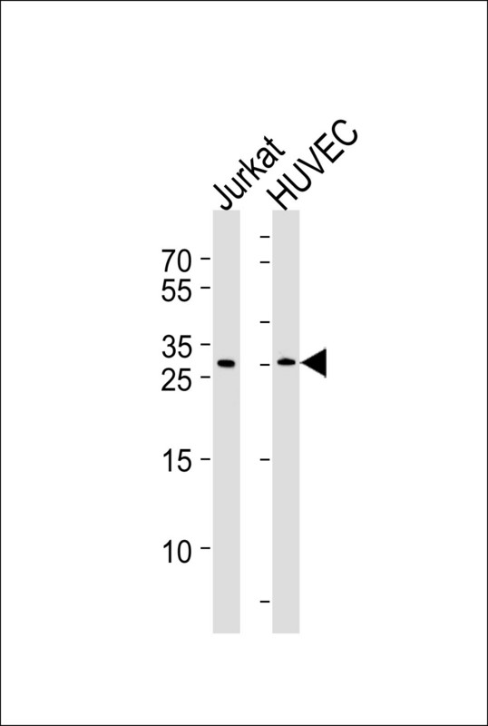 Western blot of lysates from Jurkat, HUVEC cell line (from left to right), using DKK4 Antibody. Antibody was diluted at 1:1000 at each lane. A goat anti-rabbit IgG H&L (HRP) at 1:5000 dilution was used as the secondary antibody. Lysates at 35ug per lane.