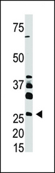The anti-DKK4 is used in Western blot to detect DKK4 in A375 cell lysate.