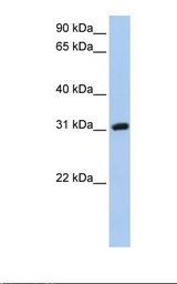 HepG2 cell lysate. Antibody concentration: 1.0 ug/ml. Gel concentration: 12%.