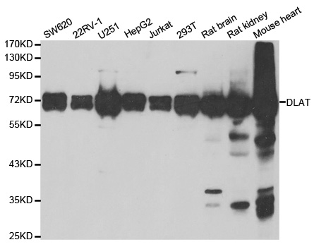 Western blot analysis of extracts of various cell lines, using DLAT antibody.