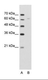 A: Marker, B: Jurkat Cell Lysate