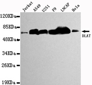 Western blot detection of DLAT in Jurkat,A549,U251,F9,LNCAP&Hela cell lysates using DLAT antibody (1:1000 diluted).
