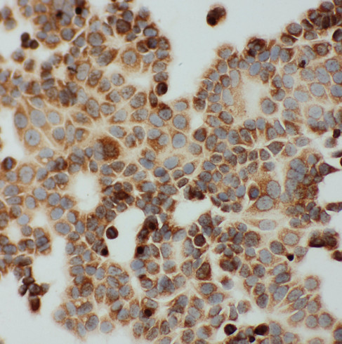 DLD / Diaphorase / E3 antibody. ICC: MCF-7 Cell.