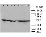 WB of DLD / Diaphorase / E3 antibody. Lane 1: Rat Liver Tissue Lysate. Lane 2: Rat Brain Tissue Lysate. Lane 3: Rat Ovary Tissue Lysate. Lane 4: Rat Testis Tissue Lysate. Lane 5: SMMC Cell Lysate. Lane 6: HELA Cell Lysate. Lane 7: SMMC Cell Lysate. Lane 8: JURKAT Cell Lysate.