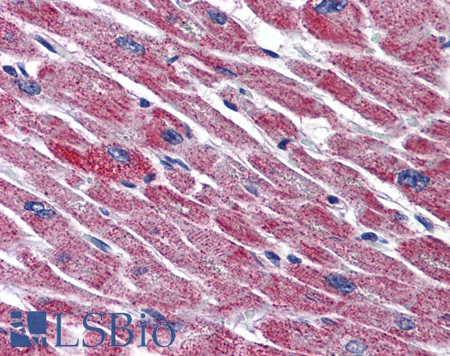 Anti-DLD / DLDH antibody IHC of human heart. Immunohistochemistry of formalin-fixed, paraffin-embedded tissue after heat-induced antigen retrieval. Antibody LS-B6077 concentration 5 ug/ml.