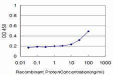 Detection limit for recombinant GST tagged DLD is approximately 1 ng/ml as a capture antibody.