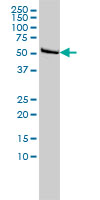 Western blot of DLD expression in HeLa cell lysate.