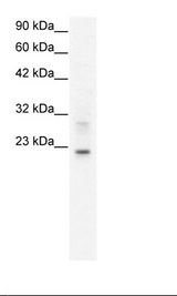 HepG2 Cell Lysate