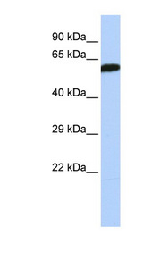 DLD / DLDH antibody LS-C102781 Western blot of Jurkat lysate.