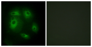 Immunofluorescence of HeLa cells, using DLEC1 Antibody. The picture on the right is treated with the synthesized peptide.
