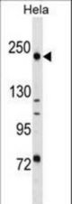 DLEC1 Antibody western blot of HeLa cell line lysates (35 ug/lane). The DLEC1 antibody detected the DLEC1 protein (arrow).