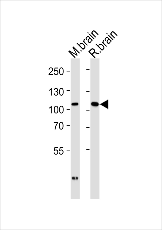 Western blot of tissue lysates from mouse brain and rat brain (from left to right) with DLG2 Antibody. Antibody was diluted at 1:1000 at each lane. A goat anti-rabbit IgG H&L (HRP) at 1:5000 dilution was used as the secondary antibody. Lysates at 35 ug per lane.