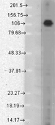 Western blot analysis of Chapsyn-110 in rat brain membrane lysates using a 1:1000 dilution of DLG2 / PSD93 antibody.