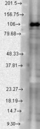 SAP102 (S19-2), Rat brain extract.