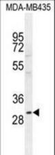 CLEC10A Antibody western blot of MDA-MB435 cell line lysates (35 ug/lane). The CLEC10A antibody detected the CLEC10A protein (arrow).