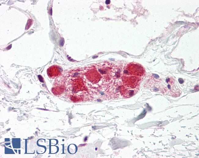 Anti-PSD95 antibody IHC of human colon, submucosal plexus. Immunohistochemistry of formalin-fixed, paraffin-embedded tissue after heat-induced antigen retrieval. Antibody LS-B8203 dilution 2.5-5 ug/ml.