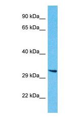 Western blot of CLEC10A Antibody with human HepG2 Whole Cell lysate.