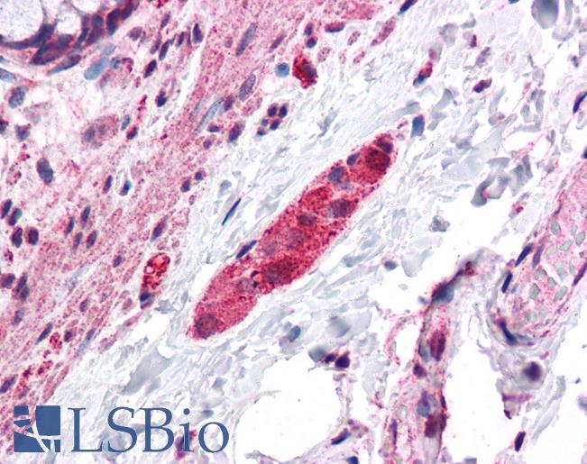 Anti-DLGAP2 antibody IHC of human colon-ganglion cells. Immunohistochemistry of formalin-fixed, paraffin-embedded tissue after heat-induced antigen retrieval. Antibody LS-B4593 concentration 5 ug/ml.
