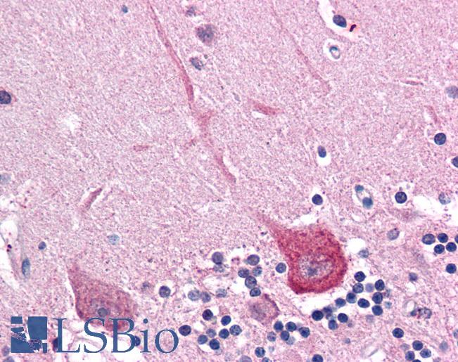 Anti-DLGAP2 antibody IHC of human brain, cerebellum. Immunohistochemistry of formalin-fixed, paraffin-embedded tissue after heat-induced antigen retrieval. Antibody LS-B4593 concentration 5 ug/ml.