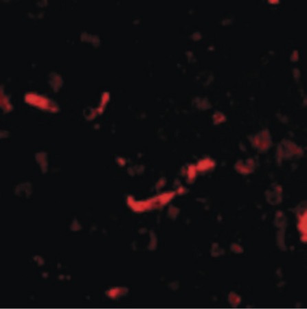 Immunofluorescence of SAPAP2 in Human Brain cells with SAPAP2 antibody at 20 ug/ml.