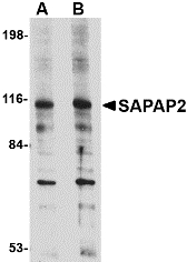 Western blot of DLGAP2 in L1210 cell lysate with DLGAP2 antibody at (A) 0.5 and (B) 1 ug/ml.